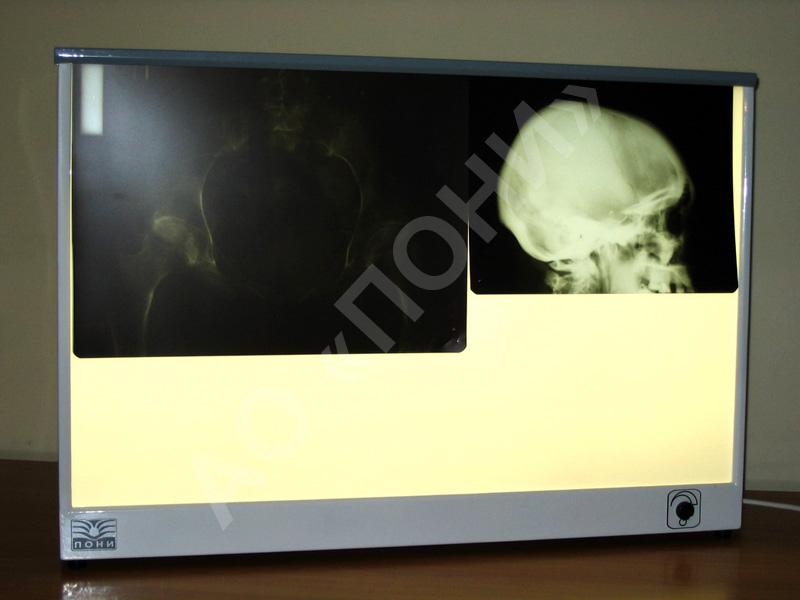 Негатоскоп, негатоскоп общего назначения. Медицинское оборудование Негатоскоп общего назначения с высотой экрана 430 мм